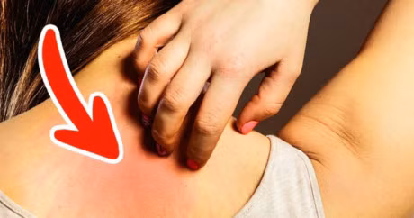 Nhung dau hieu ung thu som ma 90% thuong bo qua - Anh 1