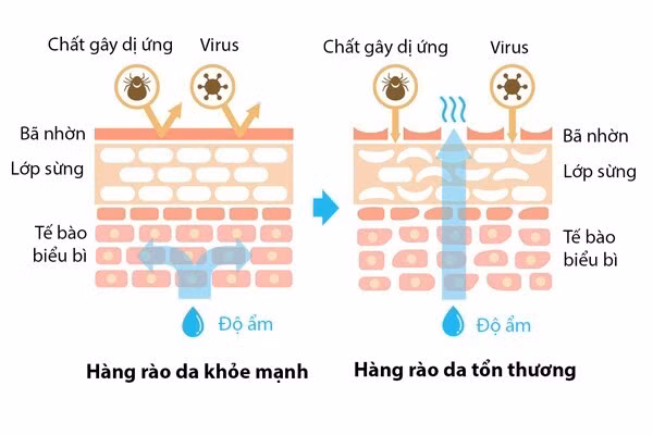 Hình ảnh mô phỏng hàng rào da khỏe mạnh và da tổn thương