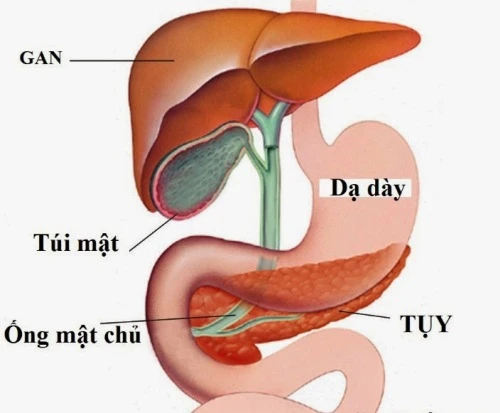 Bị sỏi mật nên mổ hay uống thuốc