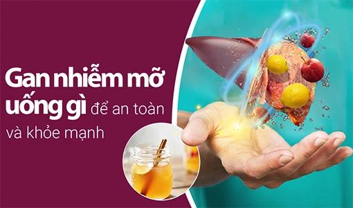 Gan nhiễm mỡ có thể phục hồi ở giai đoạn đầu