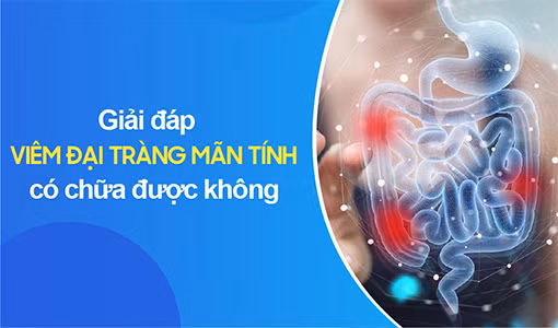 Viêm đại tràng mãn tính ảnh hưởng lớn sinh hoạt và cuộc sống
