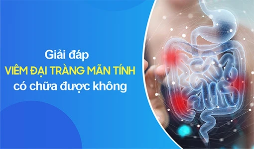 Viêm đại tràng mãn tính ảnh hưởng lớn sinh hoạt và cuộc sống