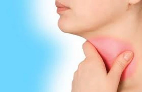 Ung thư vòm họng từ những nguyên nhân không ngờ tới