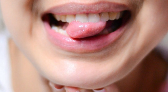 Những bất thường ở lưỡi có thể là dấu hiệu của một số bệnh lý nghiêm trọng. Ảnh: whstatic