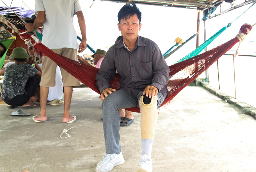 Mất 1 chân sau vụ tai nạn khi đi biển khiến ông Quảng không thể theo tàu vươn khơi. Mất 1 chân sau vụ tai nạn khi đi biển khiến ông Quảng không thể theo tàu vươn khơi.