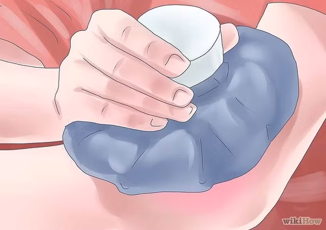 6 mẹo trị mề đay tại nhà