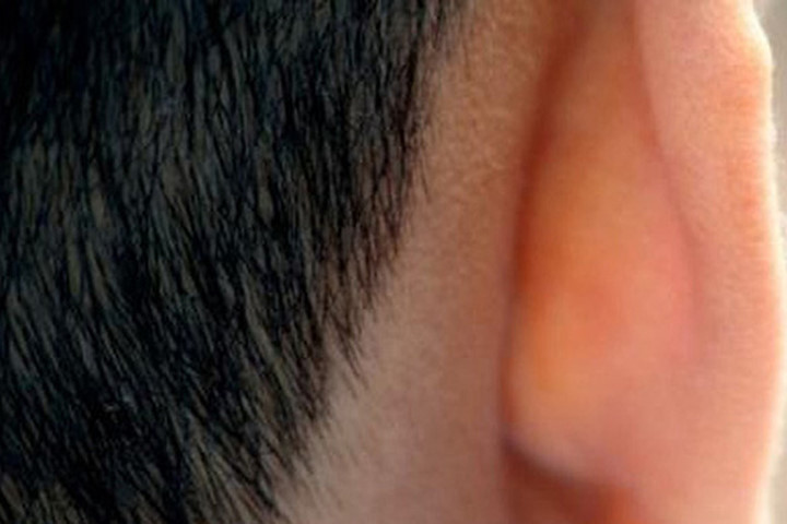 5 vị trí không ngờ có thể bị ung thư da