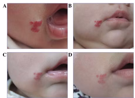 Vi sao mot so vet bot tren co the lai khong bao gio bien mat? - Anh 2