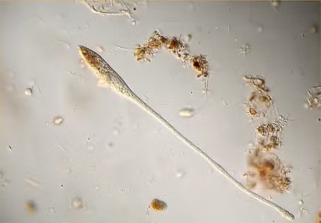 Ron nguoi canh quai khuan 