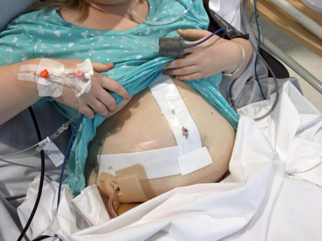 Uong thuoc tranh thai 12 nam lien tuc, thieu nu bi u gan - Anh 4