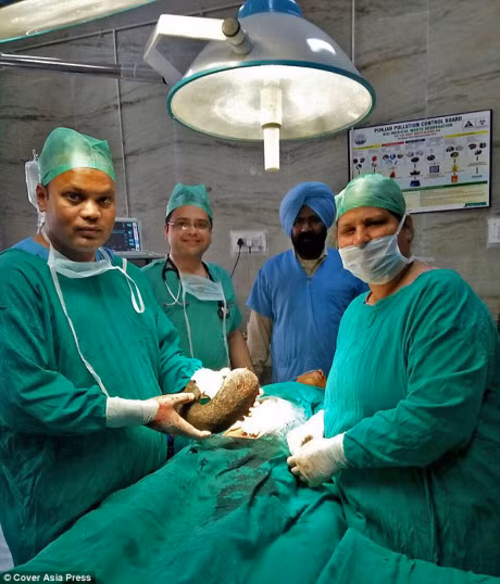 Bui toc nang 1kg trong bung thieu nu 15 tuoi - Anh 2