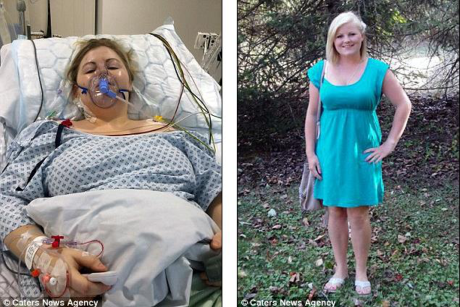 Uong thuoc tranh thai 12 nam lien tuc, thieu nu bi u gan - Anh 2