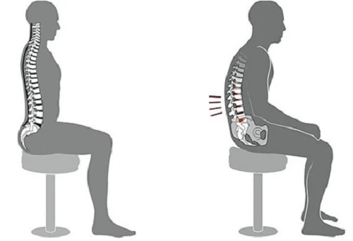 Tư thế ngồi đúng (trái) và sai (phải). Ảnh:Health.