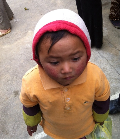 Những em nhỏ mặt khô nẻ vì giá rét. Ảnh: gdtd.vn