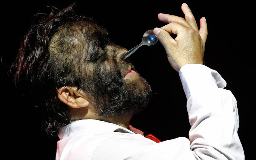 Những hình ảnh ấn tượng trong tuần ảnh 4 Jesus Aceves, who has hypertrichosis - a skin condition where an abnormal amount of hair growth is present on the body - inserts a teaspoon into his nose during a rehearsal for the Circus of Horrors at the Churchill Theatre in Bromley, south east London. The circus has had to advertise advertised for a wolf man or woman on the government jobs website Directgov. The circus have Mexican wolf man, Aceves, but new UK Border Agency rules meant that before a worker can be granted a certificate of sponsorship, the company must advertise the job in Britain.