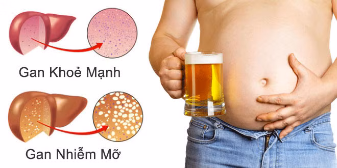 Rượu phá huỷ gan như thế nào?
