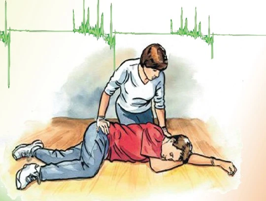 Nhiều bệnh lý có biểu hiện giống như đột quỵ não, đó là đột quỵ não giả