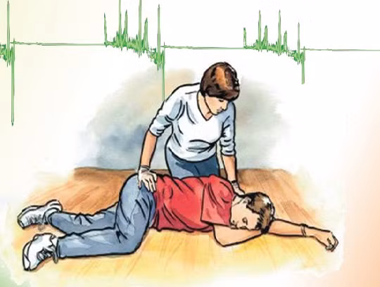 Nhiều bệnh lý có biểu hiện giống như đột quỵ não, đó là đột quỵ não giả