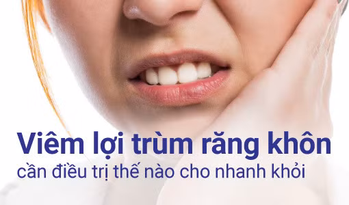 Viêm lợi trùm răng khôn gây đau nhức và ảnh hưởng đến sinh hoạt hàng ngày