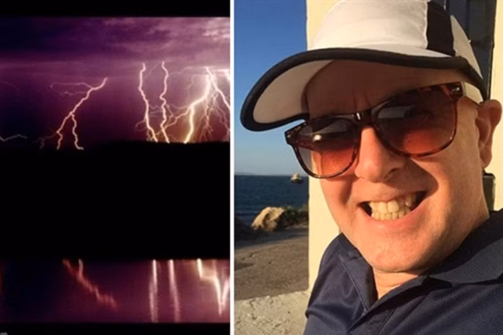 Người đàn ông bất ngờ sở hữu "siêu năng lực" sau khi bị sét đánh