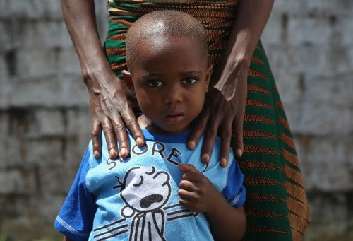 Chân dung một bệnh nhi Ebola đã hồi phục tại Liberia. Theo nghiên cứu mới này, nhóm người nhiễm Ebola dưới 21 tuổi có khả năng sống sót cao hơn. Ảnh: Huffingtonpost