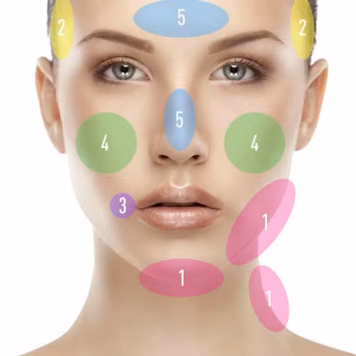 Những vị trí dễ nổi mụn trên mặt bạn. Ảnh: Cosmopolitan.com.