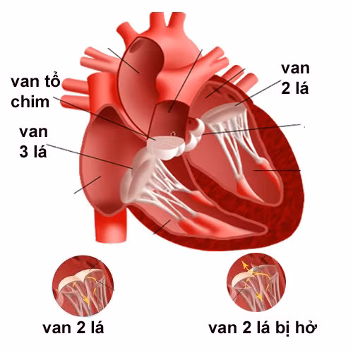 Dấu hiệu nhận biết bệnh lý van tim ảnh 1