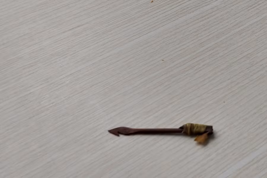 Mũi tên đâm xuyên mắt cháu bé được các y bác sĩ phẫu thuật lấy ra.