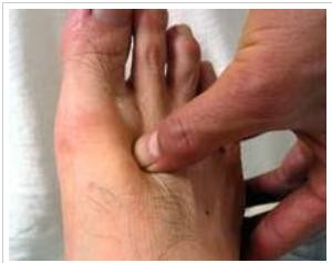 Huyệt thái xung Huyệt thái xung