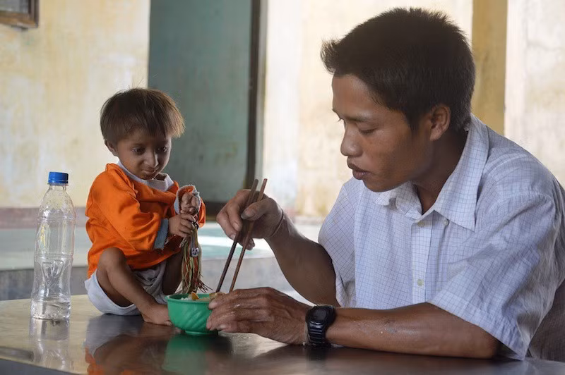 K"Rể được chẩn đoán mắc chứng bệnh hiếm gặp - Seckel (người lùn, đầu chim). Ảnh: C.Đ.