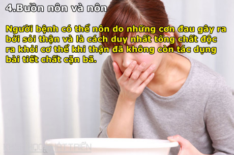 8 dấu hiệu cảnh báo bệnh sỏi thận - Ảnh 4 8 dau hieu canh bao benh soi than - Anh 4