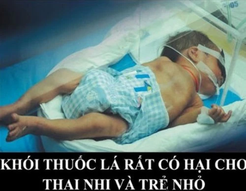 Phụ nữ và trẻ em là nạn nhân chính của hút thuốc lá thụ động.
