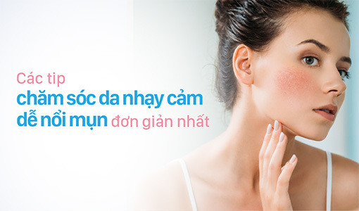 Chăm sóc da nhạy cảm dễ nổi mụn là điều không đơn giản