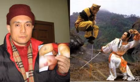 Truong Ve Kien va be boi danh tai tu 