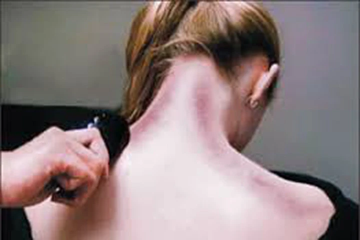 Hướng dẫn cạo gió chữa cảm lạnh