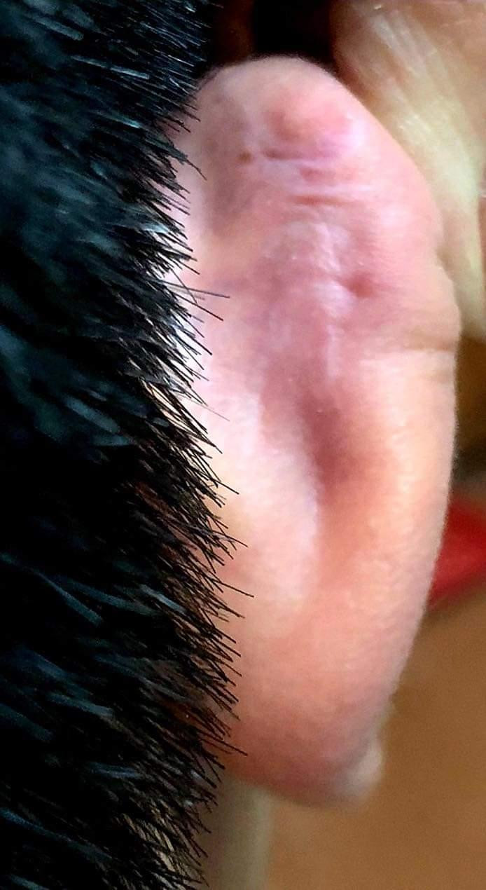 Vùng tai của cháu T. bị thương tích do thầy Q. đánh (Ảnh: Gia đình cung cấp). Vùng tai của cháu T. bị thương tích do thầy Q. đánh (Ảnh: Gia đình cung cấp).