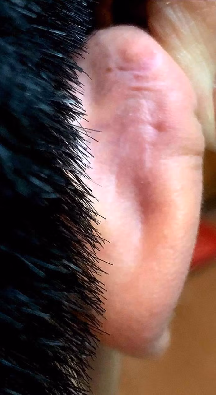 Vùng tai của cháu T. bị thương tích do thầy Q. đánh (Ảnh: Gia đình cung cấp).