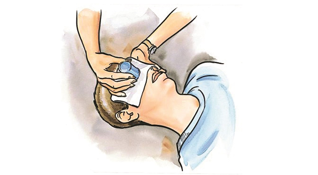 Cách sơ cứu các vết thương trên mặt