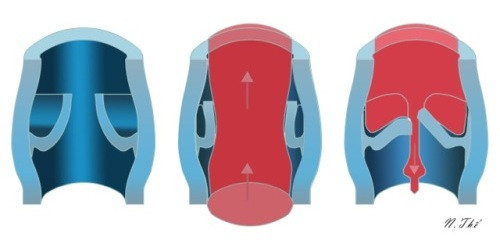 Đi bộ có lợi cho người suy giãn tĩnh mạch ảnh 1 suy-tinh-mach-co-nen-han-che-di-bo-1