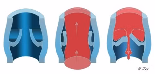 suy-tinh-mach-co-nen-han-che-di-bo-1