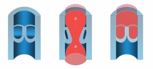 
Cơ chế hoạt động của van tĩnh mạch. Từ trái qua: (1) van tĩnh mạch, (2) van mở ra cho dòng máu đi lên trên, (3) sau đó van đóng lại ngăn máu chảy ngược xuống. Ảnh:Ngọc Thể.