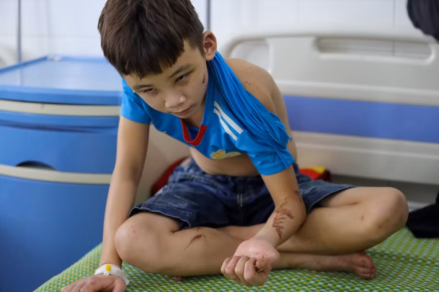 Em Trương Quang Duy - một trong hai nhân viên quán bánh xèo bị chủ hành hạ suốt một thời gian dài. Ảnh: Phạm Chiểu