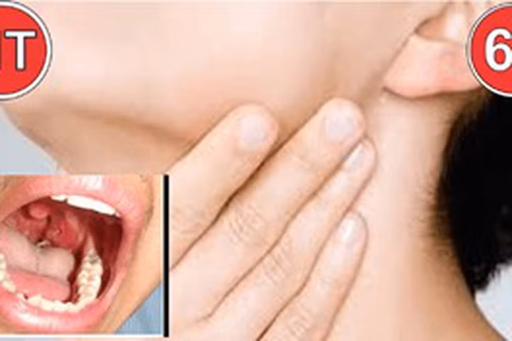 Cách chữa hóc xương cá hay nuốt phải vật cứng