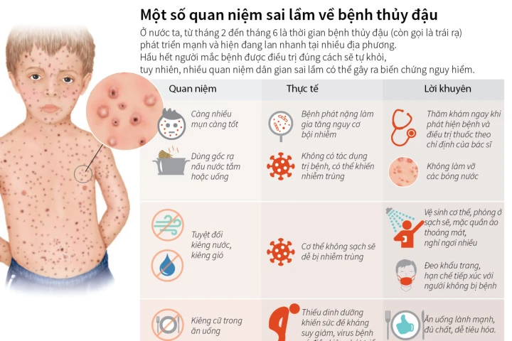 Một số quan niệm sai lầm về bệnh thủy đậu