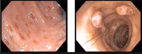 Nguoi phu nu chi con da boc xuong do nhiem giun luon - Anh 1