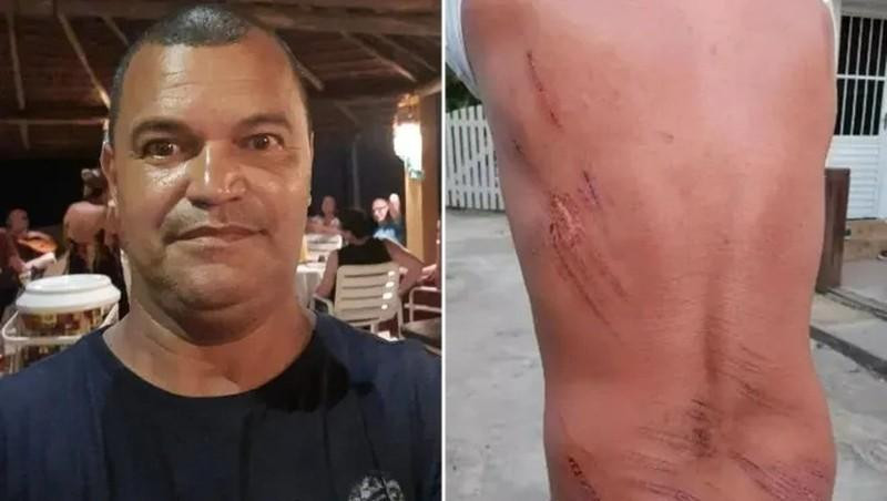 Những vết thương do bị va đập trên người Nelson Nedy. Ảnh: Daily Mail. Những vết thương do bị va đập trên người Nelson Nedy. Ảnh: Daily Mail.