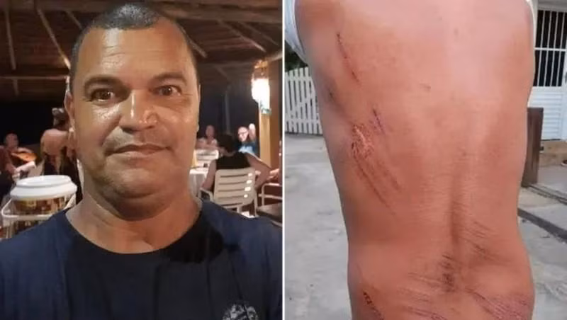 Những vết thương do bị va đập trên người Nelson Nedy. Ảnh: Daily Mail.