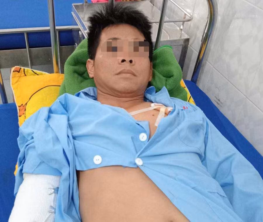 Chủ nuôi bị chó dữ cắn trọng thương. (Ảnh: TT)