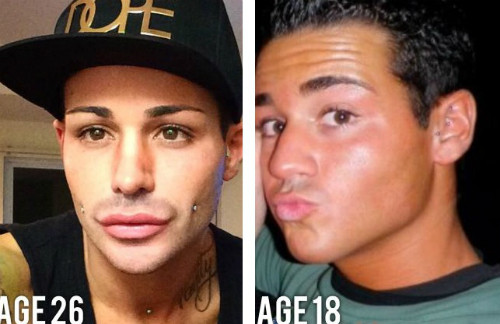 Chàng trai chi hơn 12.000 USD để có vòng ba căng đẹp ảnh 2 chang-trai-chi-hon-12000-usd-de-co-vong-ba-cang-dep-2