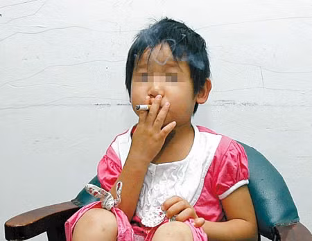 Sau tai nạn, bé gái 3 tuổi bỗng dưng... nghiện thuốc lá